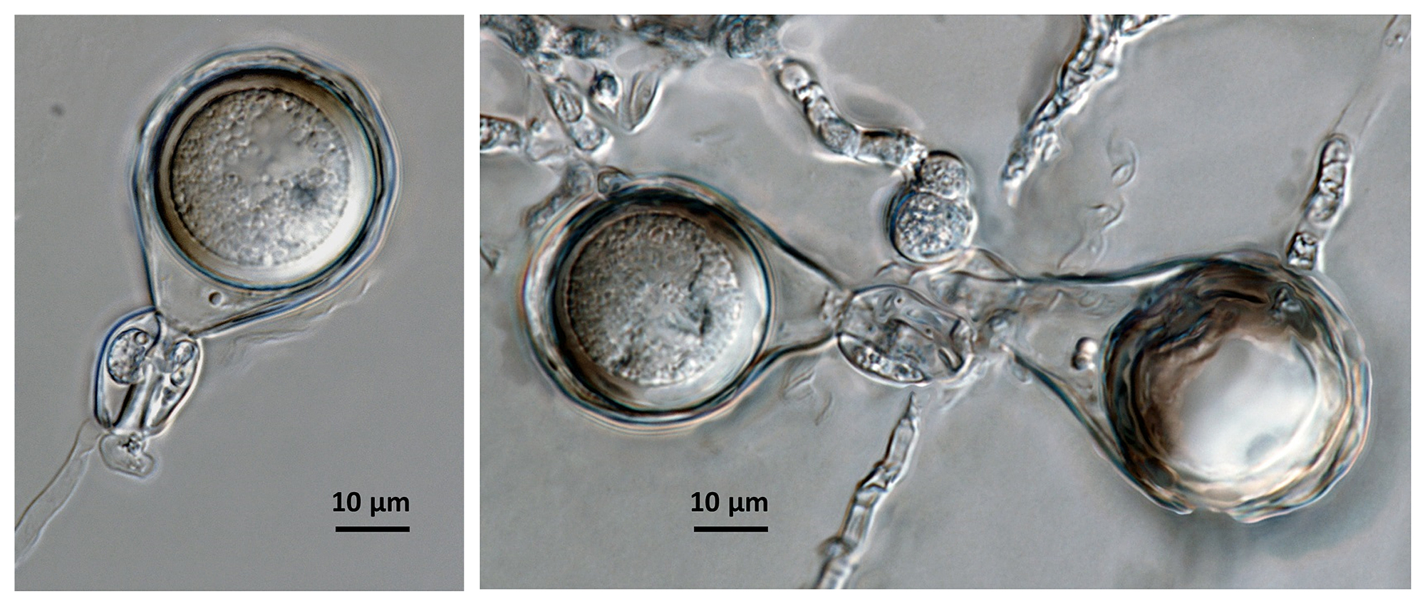 Phytophthora agathidicida nbsp;(ex-type CPHST BL 154) sexual phase formed on hemp seed agar: oogonia with wavy wall and tapered base,nbsp;amphyginous antheridia,nbsp;and plerotic, thick-walled oospores; photos by G.Abad, USDA-APHIS-PPQ.